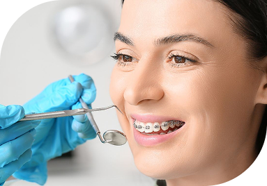 Tratamento Ortodontia para jovens e adultos jovens